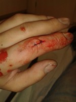 Finger genäht^^